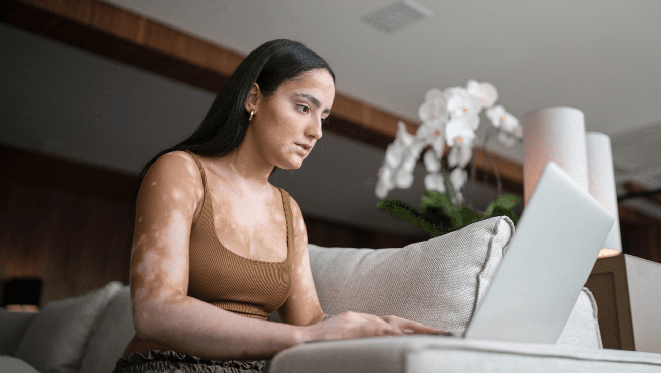 A young woman with psoriasis working at a laptop computer